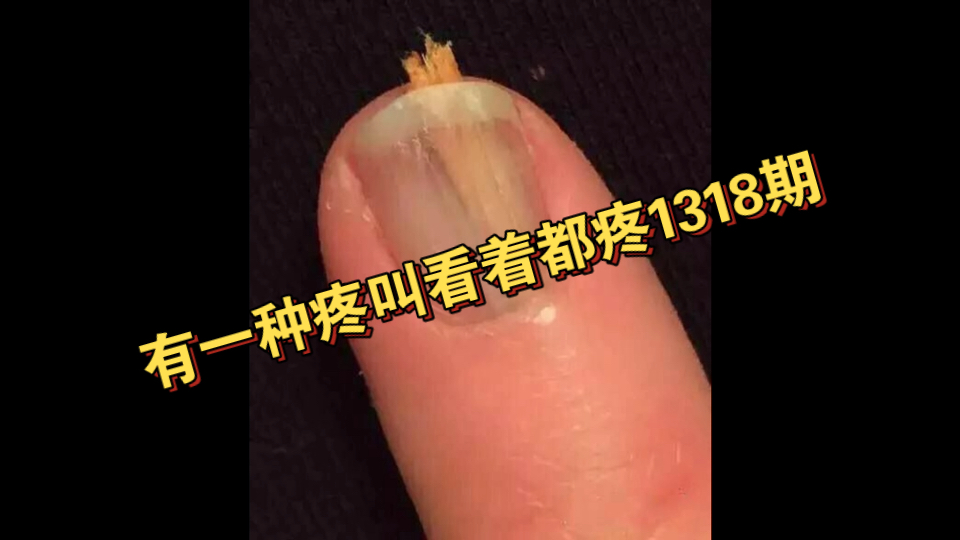 有一种疼叫看着都疼131...